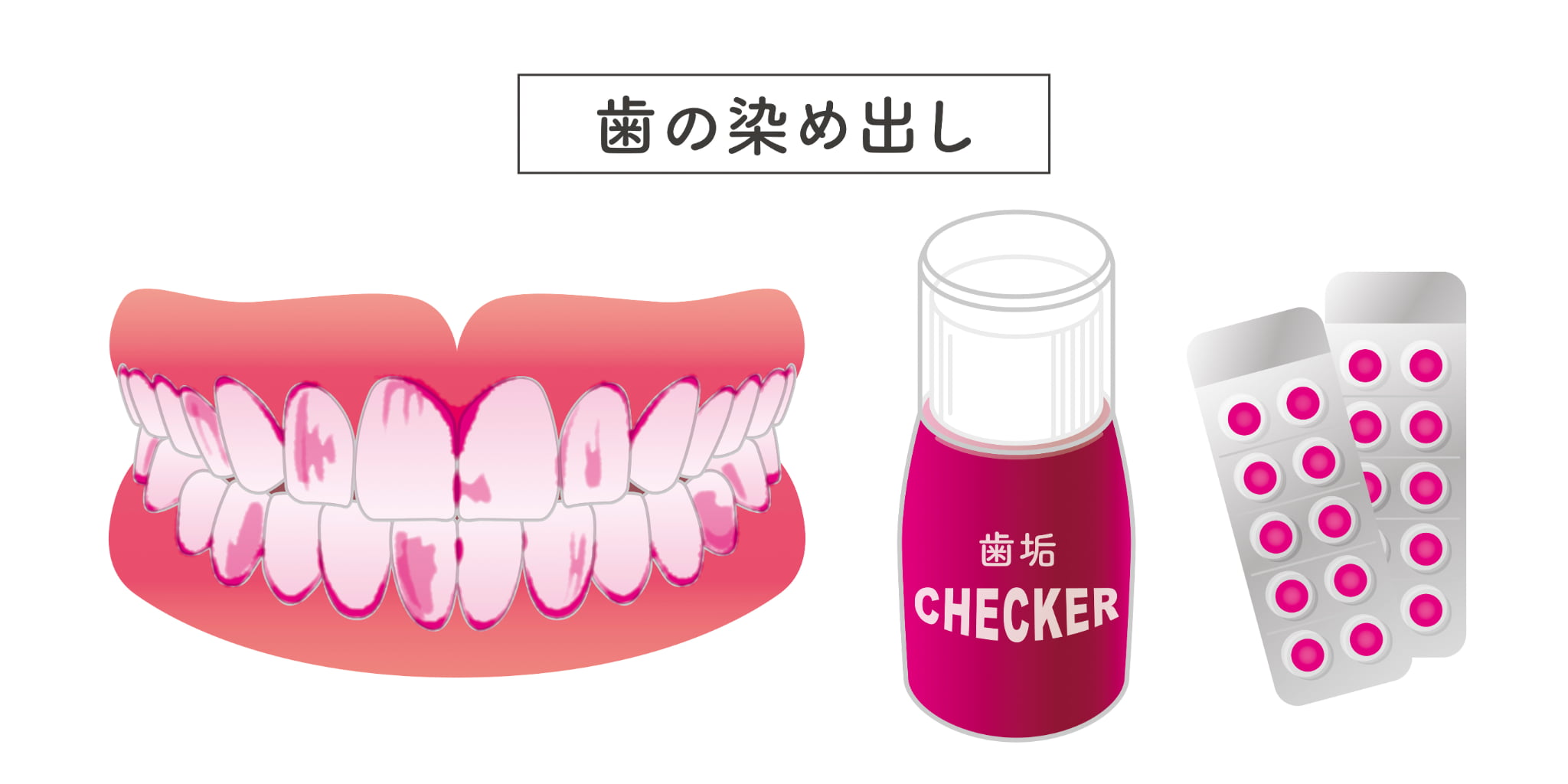 歯科医院で行うブラッシング指導で歯の染め出しをするイメージ