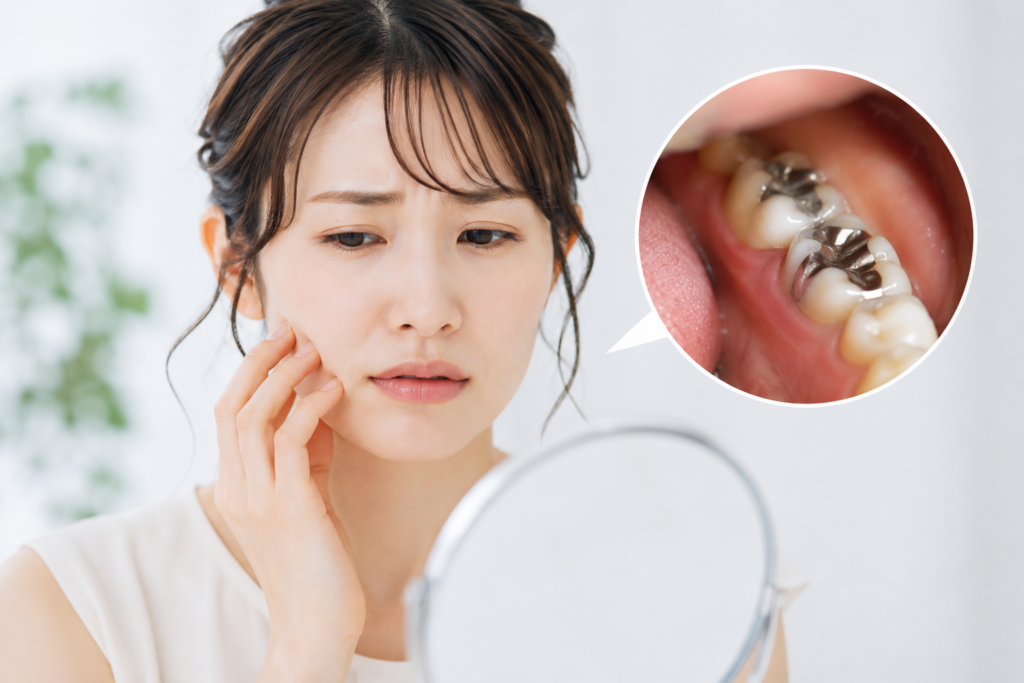 セラミック治療がお勧めの方