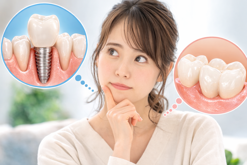 インプラントとセラミックの選択基準