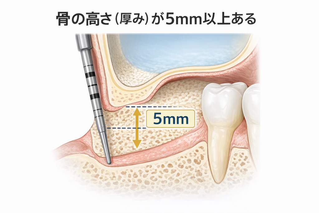 ソケットリフトの主な適応条件