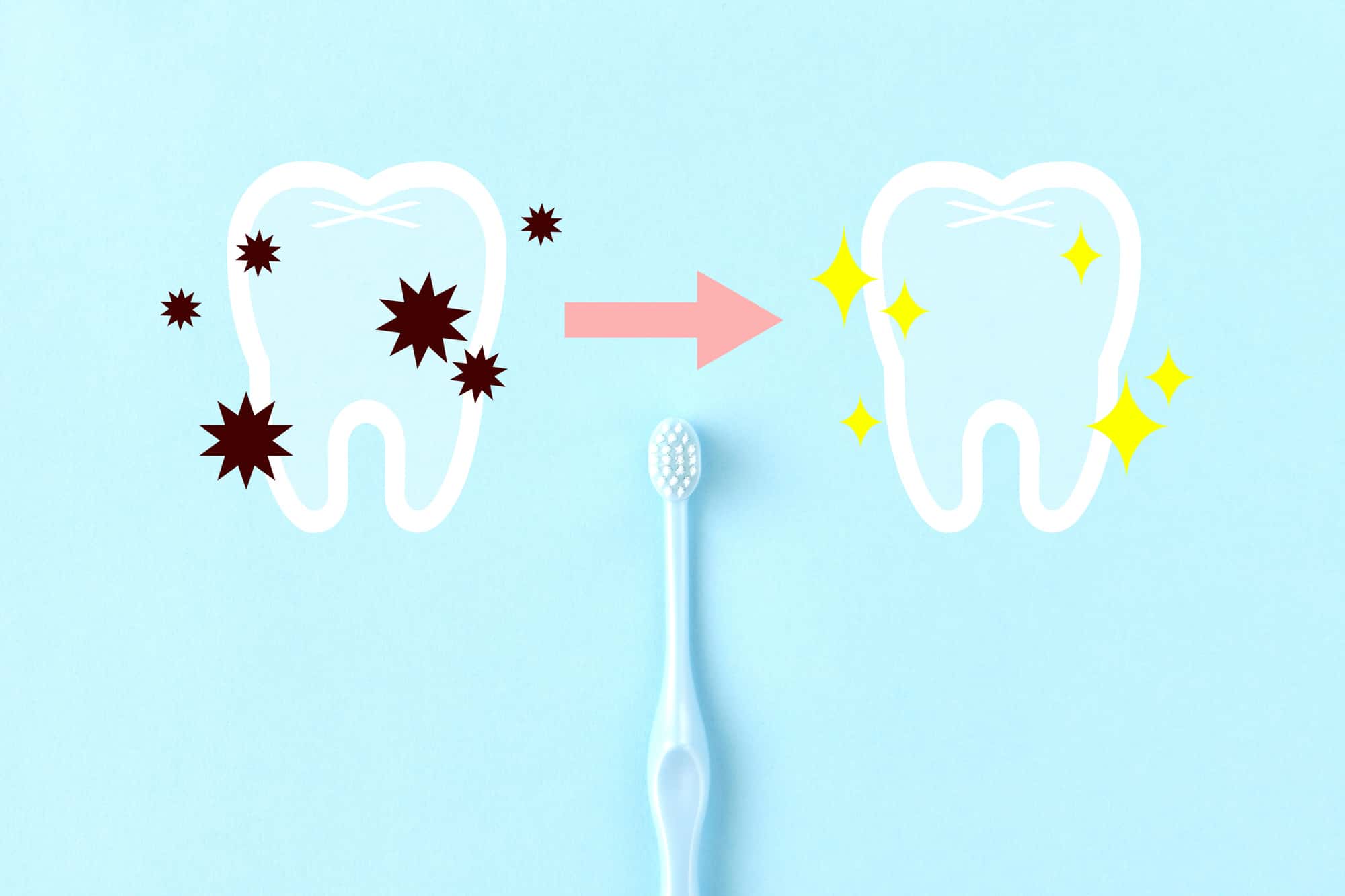 ブラッシングで歯が綺麗になるイメージ